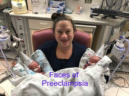 Face of Preeclampsia